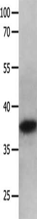 MAPK10 Antibody