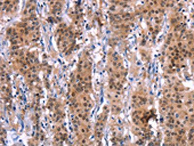 MAPK13 Antibody