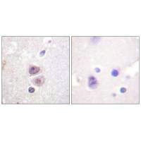 MAPK14 Antibody