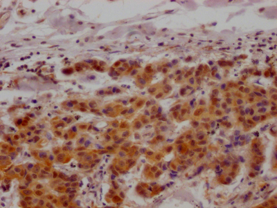 MAPKAPK2 Antibody