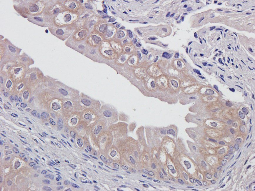 MARCO Rabbit Polyclonal Antibody