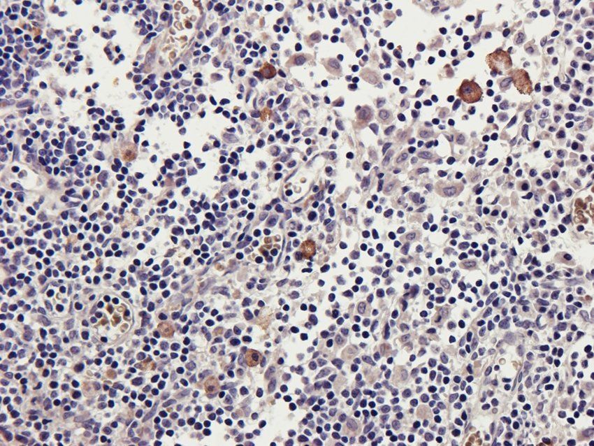 MARCO Rabbit Polyclonal Antibody