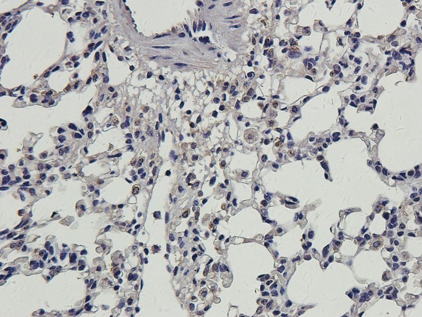 MAS Rabbit Polyclonal Antibody
