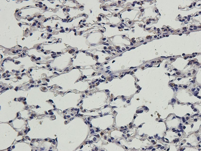 MAS Rabbit Polyclonal Antibody