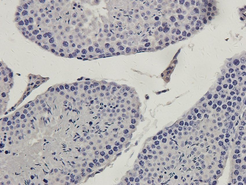 MAS Rabbit Polyclonal Antibody