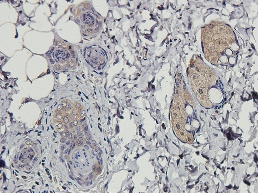 MAS Rabbit Polyclonal Antibody