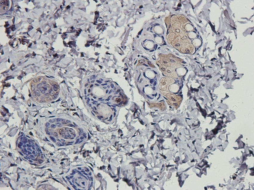 MAS Rabbit Polyclonal Antibody