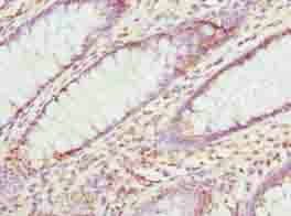 MAT2A Antibody