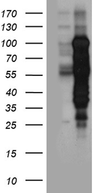 MBD1 Antibody