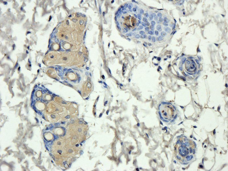 MCP3/CCL7 antibody