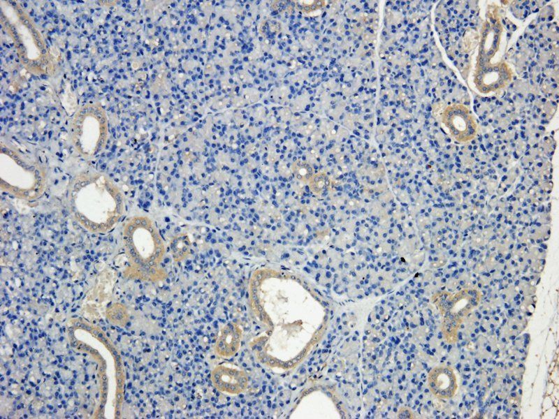 MCP5 Rabbit Polyclonal Antibody