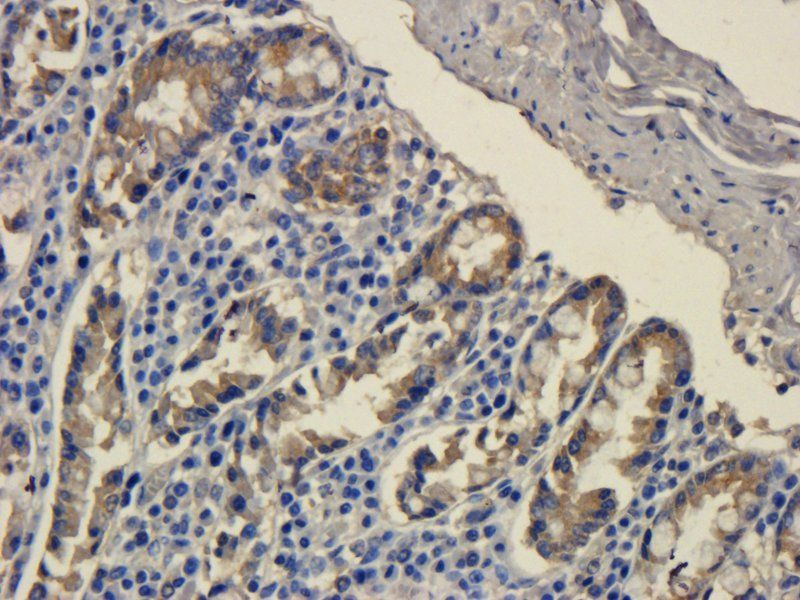 MCP5 Rabbit Polyclonal Antibody