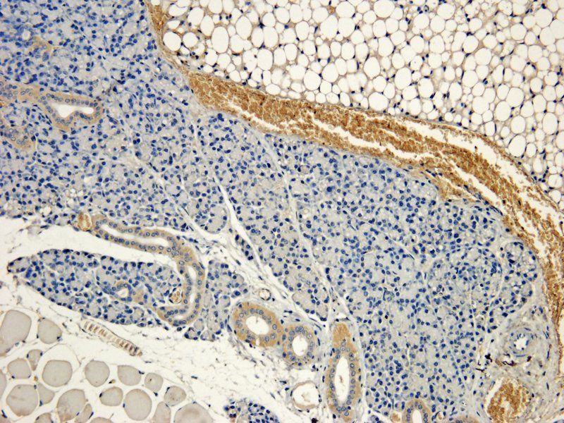 MCP5 Rabbit Polyclonal Antibody