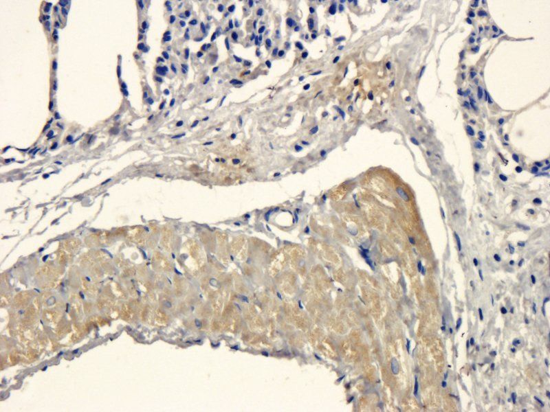 MCP5 Rabbit Polyclonal Antibody