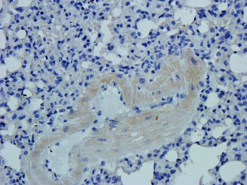 MCU Rabbit Polyclonal Antibody