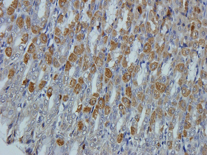MCU Rabbit Polyclonal Antibody