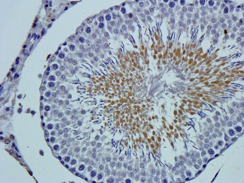 MCU Rabbit Polyclonal Antibody