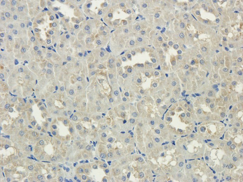 MCU Rabbit Polyclonal Antibody