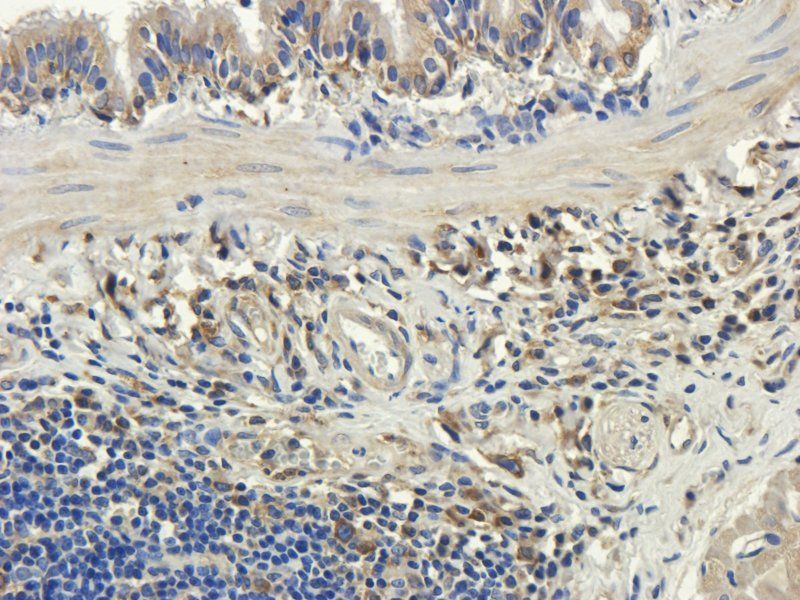 MCU Rabbit Polyclonal Antibody