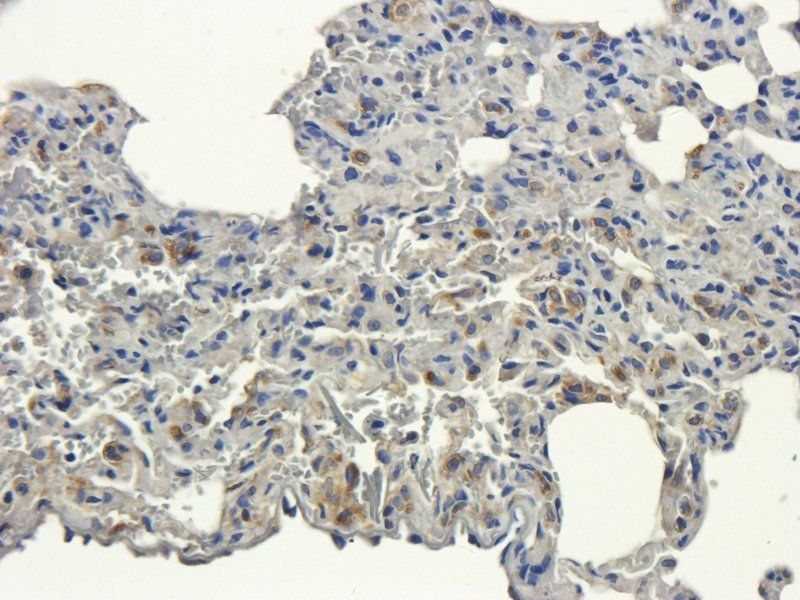 MCU Rabbit Polyclonal Antibody