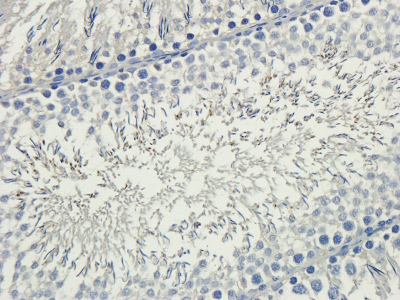 MCU Rabbit Polyclonal Antibody