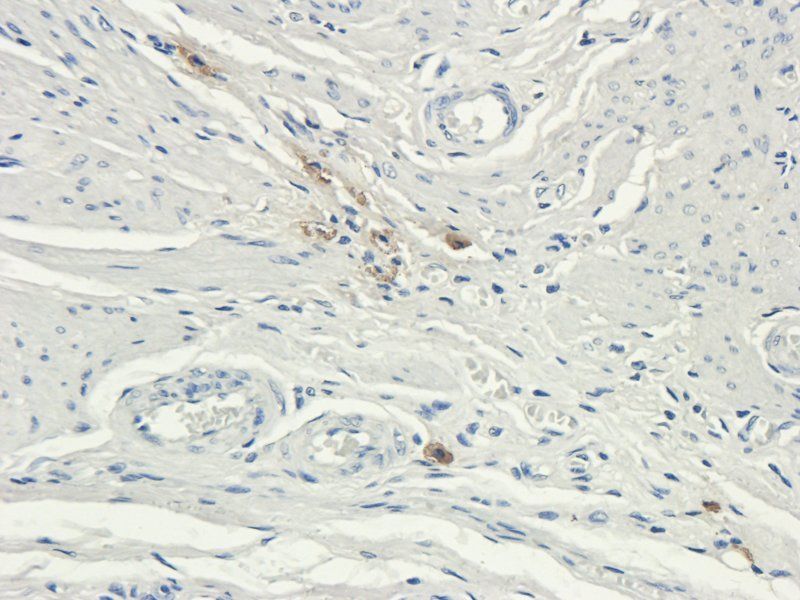 MCU Rabbit Polyclonal Antibody