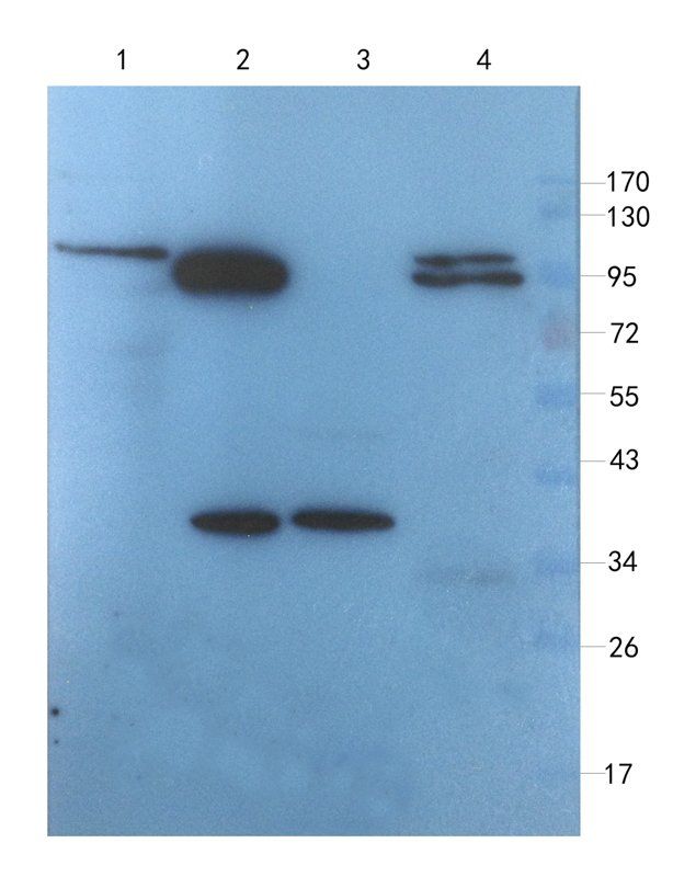 MCU Rabbit Polyclonal Antibody