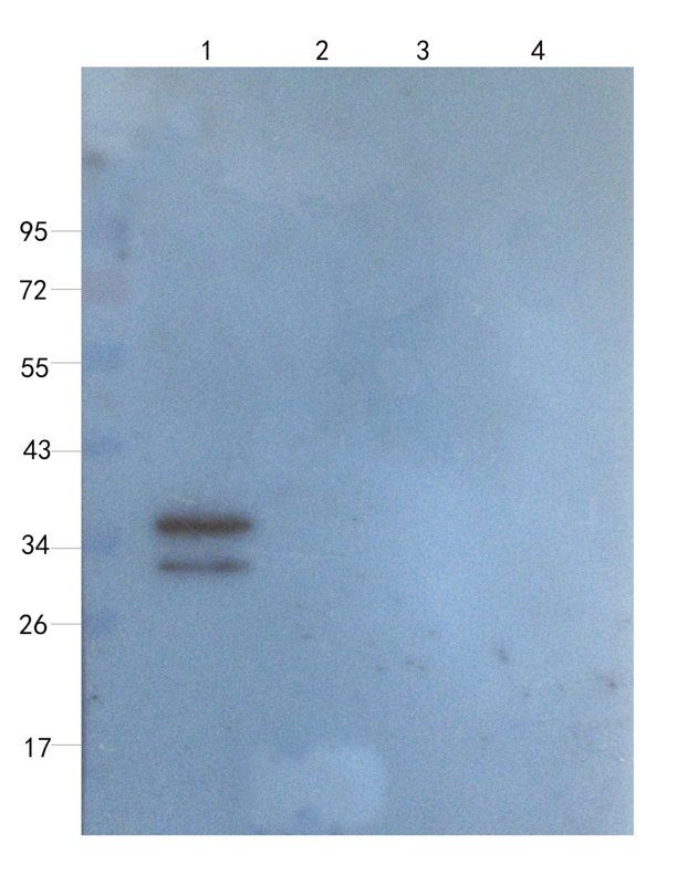 MCU Rabbit Polyclonal Antibody