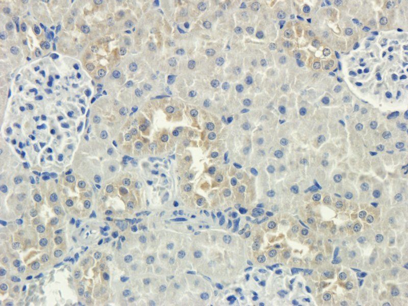 MCU Rabbit Polyclonal Antibody