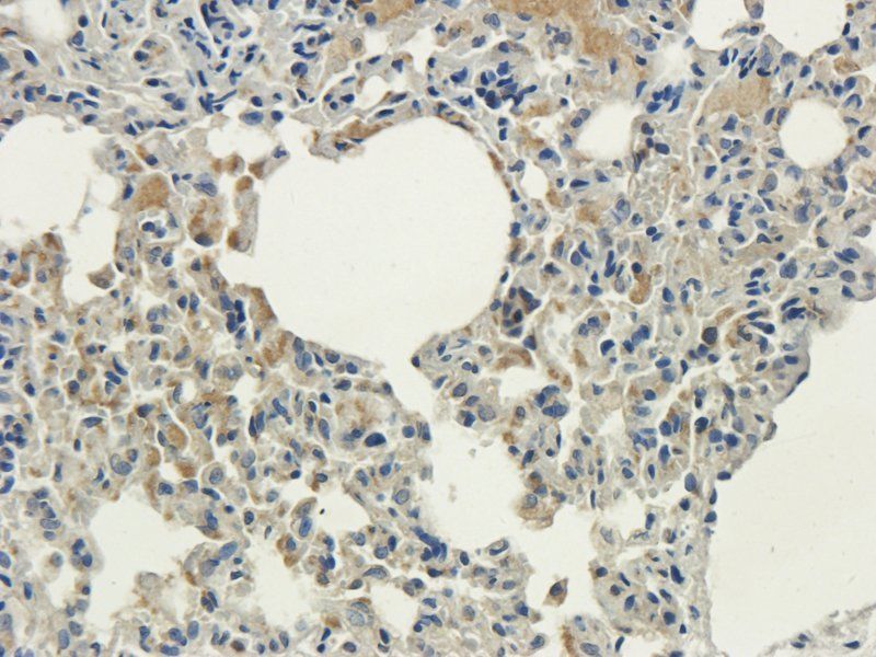 MCU Rabbit Polyclonal Antibody