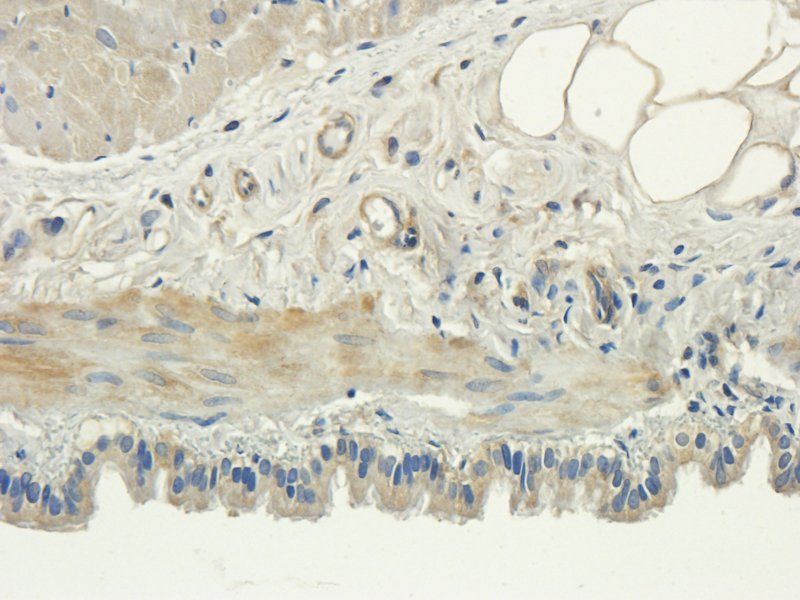 MCU Rabbit Polyclonal Antibody