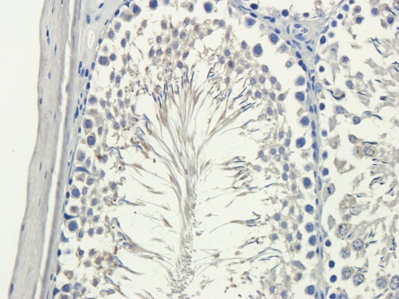 MCU Rabbit Polyclonal Antibody