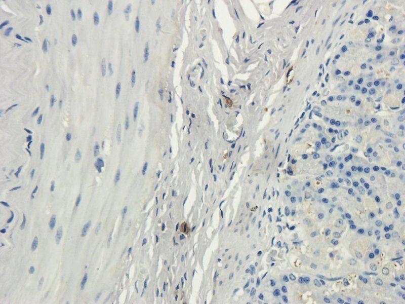 MCU Rabbit Polyclonal Antibody
