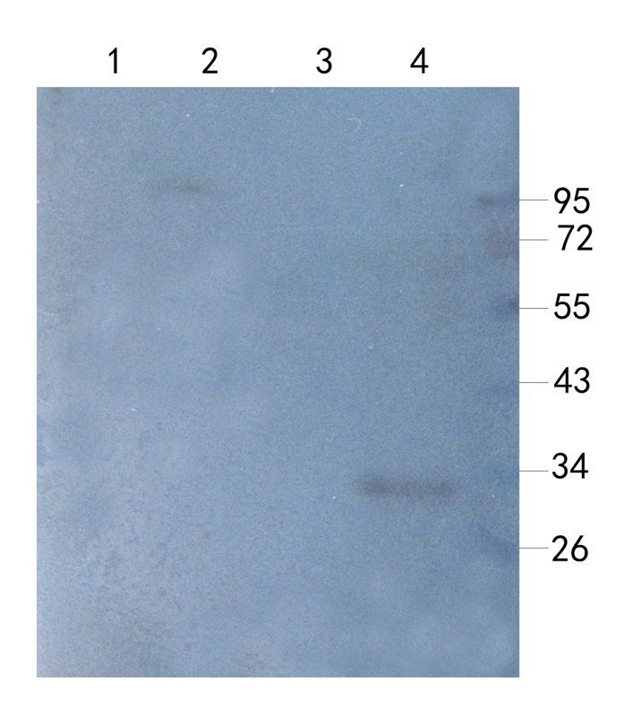 MCU Rabbit Polyclonal Antibody