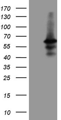MDA5 Antibody