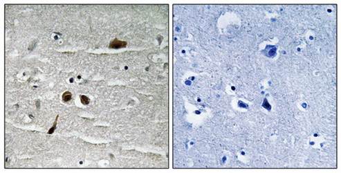 MDC1 (Phospho-Ser513) Antibody