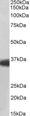 MDH1/MOR2 Antibody
