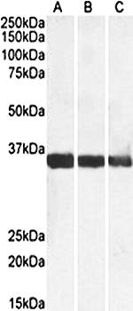 MDH1/MOR2 Antibody