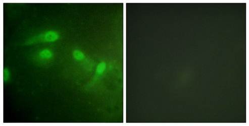 MDM2 (Phospho-Ser186+Ser188) Antibody