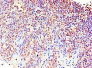 MECP2 Antibody