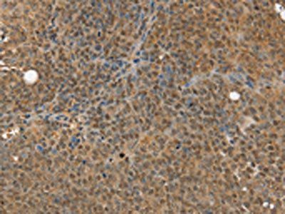 MED12 Antibody
