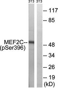 MEF2C (Phospho-Ser396) Antibody