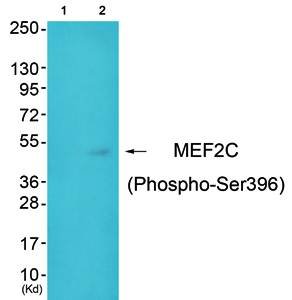 MEF2C (Phospho-Ser396) Antibody