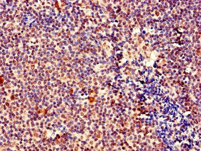 MEF2D Antibody