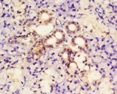 SLIT3 Rabbit Polyclonal Antibody