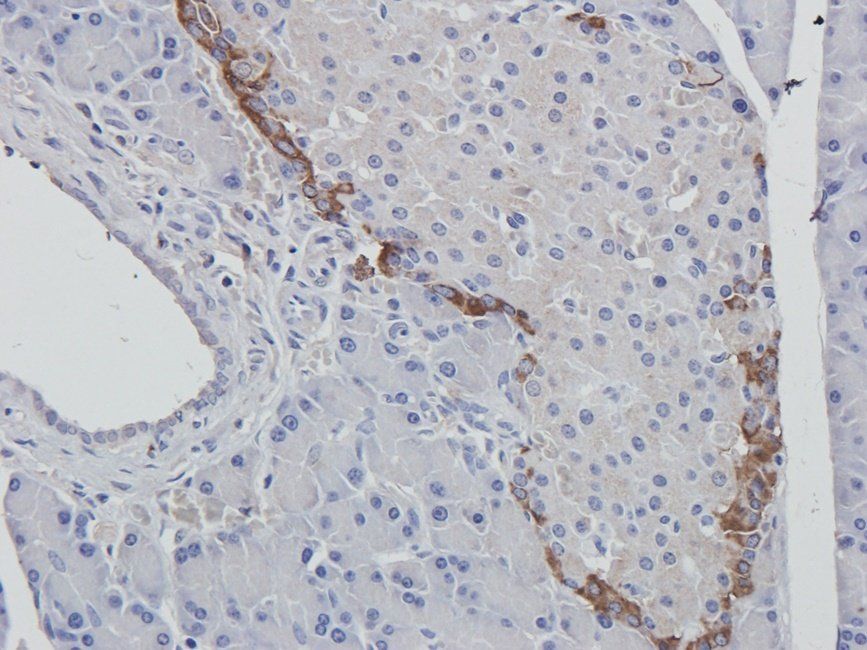 MEIS1 Rabbit Polyclonal Antibody