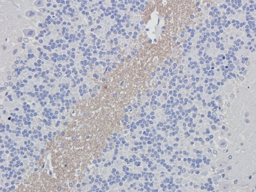 MEIS1 Rabbit Polyclonal Antibody