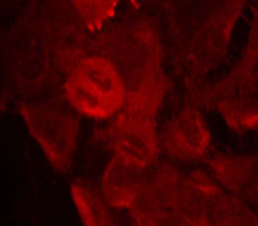 MEK-2 (Phospho-Thr394) Antibody