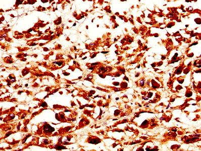 PMEL Antibody
