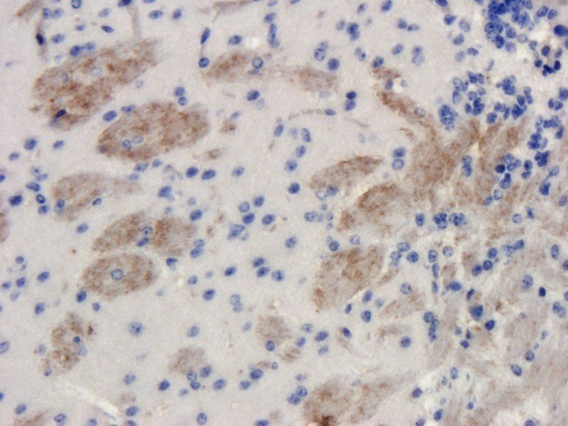 Melatonin Receptor 1B Rabbit Polyclonal Antibody